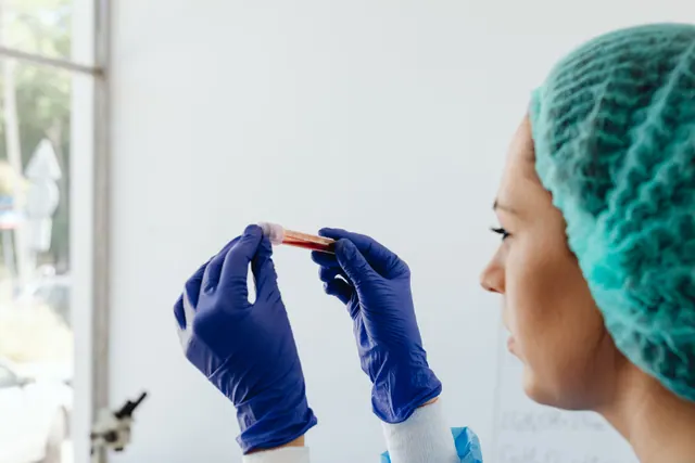 Análisis de sangre en laboratorio para el diagnóstico prenatal durante el embarazo