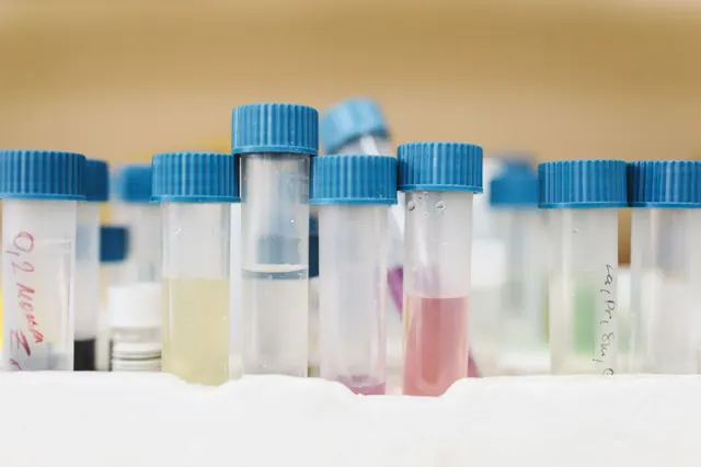 Tubos de laboratorio con líquidos de colores en un soporte