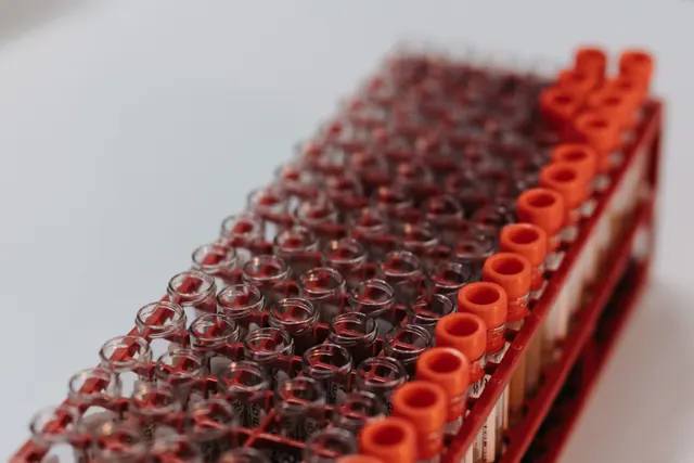 Tubos para muestras de sangre y material sanitario sobre una mesa de consulta
