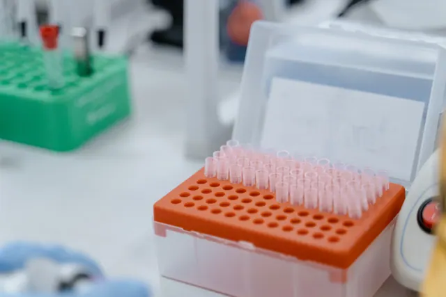 Gradillas con puntas de pipeta y tubos de ensayo en un laboratorio